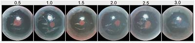 The Contribution of Anterior Segment Abnormalities to Changes in Intraocular Pressure in the DBA/2J Mouse Model of Glaucoma: DBA/2J-Gpnmb+/SjJ Mice as Critical Controls